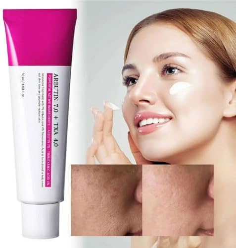 TOSOWOONG Arbutin 7 + Tranexamic Acid 4 Cream, 70,000ppm Arbutin